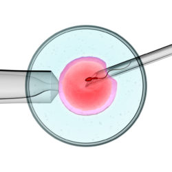 Does ICSI Cause Genetic Defects?