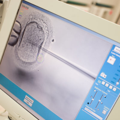 Monitor showing ICSI and Comprehensive Chromosomal Screening (CCS) | RSC Bay Area | CA