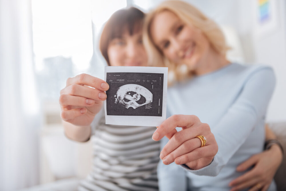 Lesbian couple holding up a photo of an ultrasound | RSC Bay Area | San Ramon, Ca